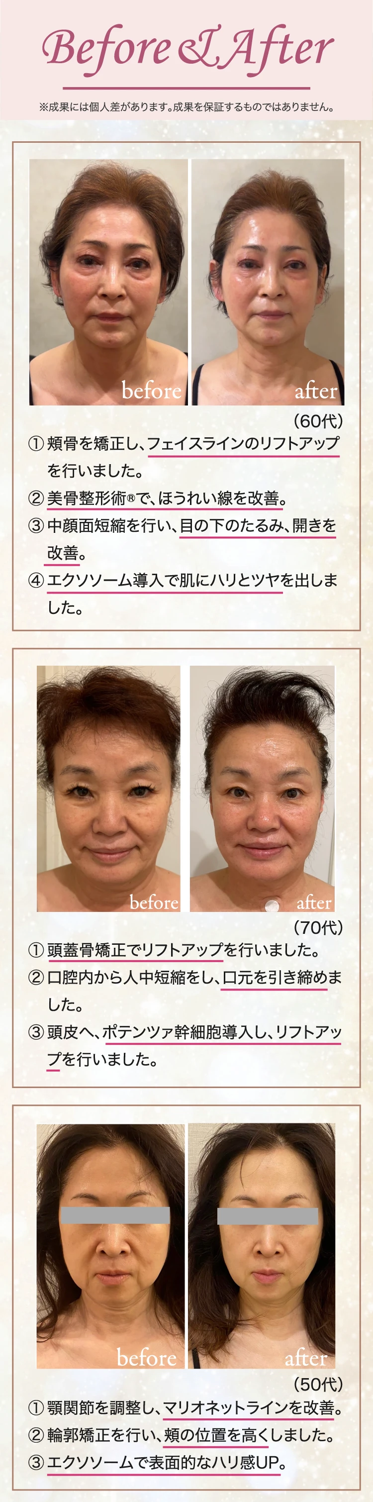 Before & After