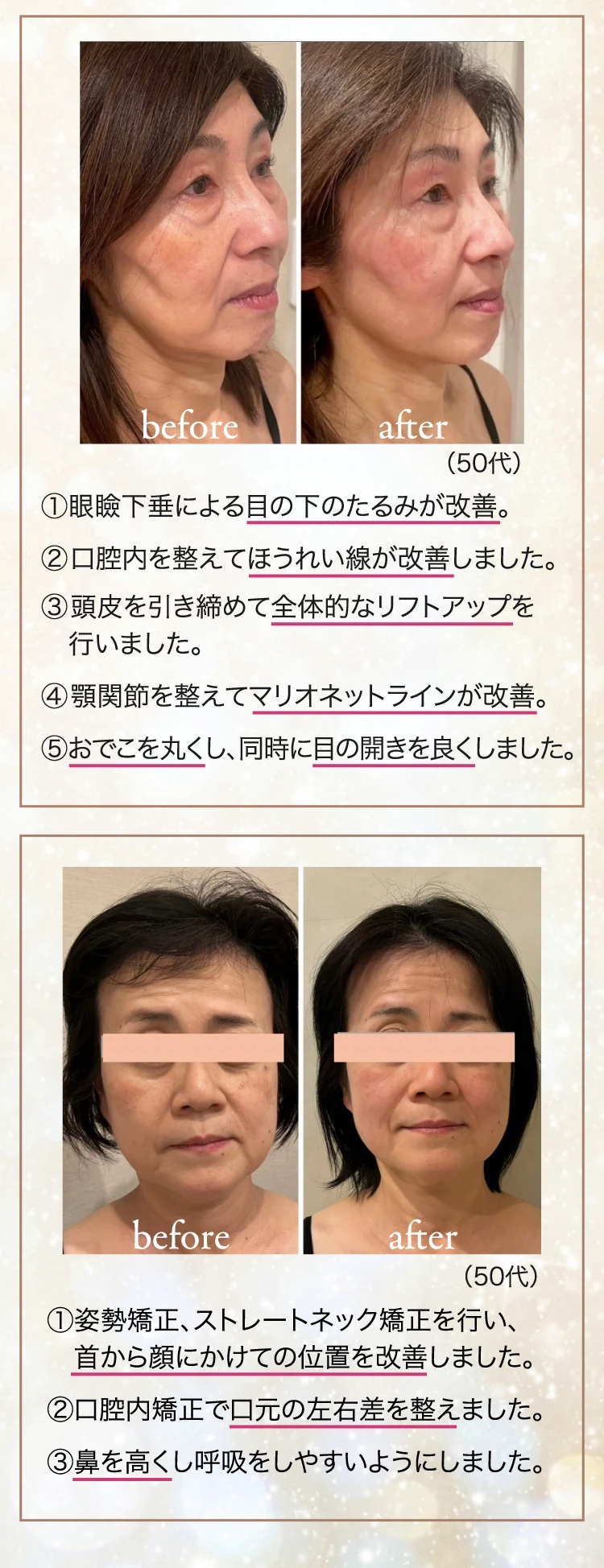 Before & After